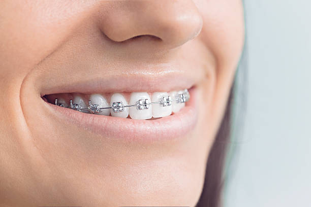 Full Mouth Reconstruction in Sierra Madre, CA